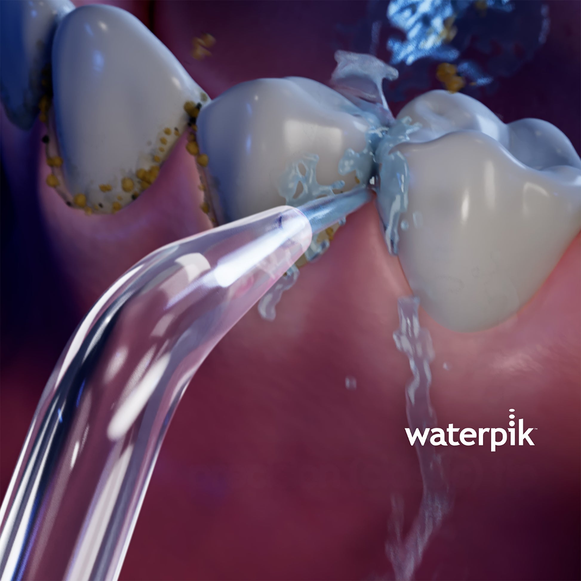 Using the Waterpik™ Precision (Classic) Tip