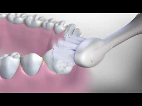 Learn how to use the Waterpik™ Sonic-Fusion™ toothbrush head.