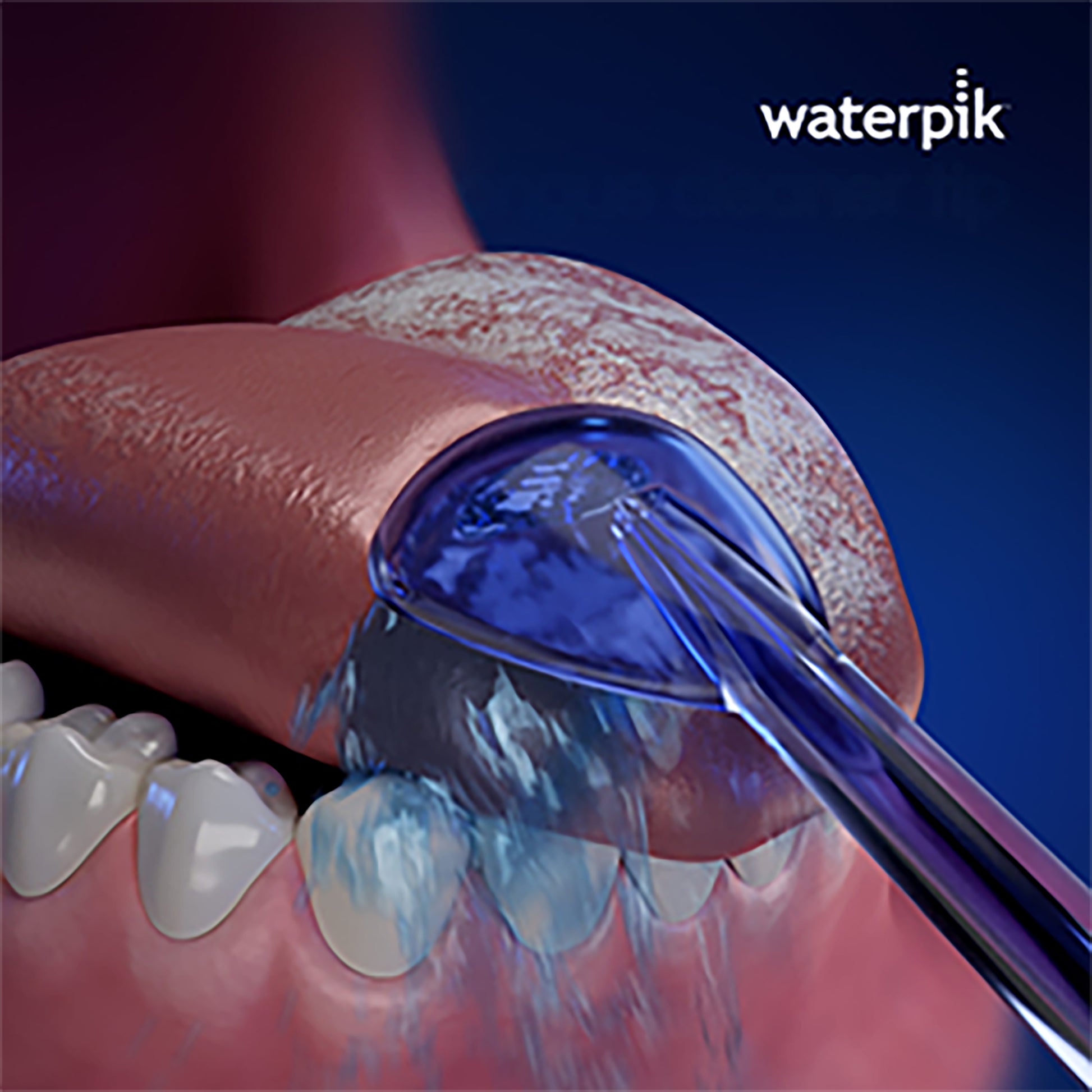 Using the Waterpik™ Water Flosser Tongue Cleaner Tip TC-100E