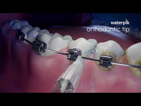 The Orthodontic tip has an innovative tapered brush to help remove hard-to-reach plaque around orthodontic brackets and wires. It also helps flush out bacteria and food debris from around the teeth and under the gums.